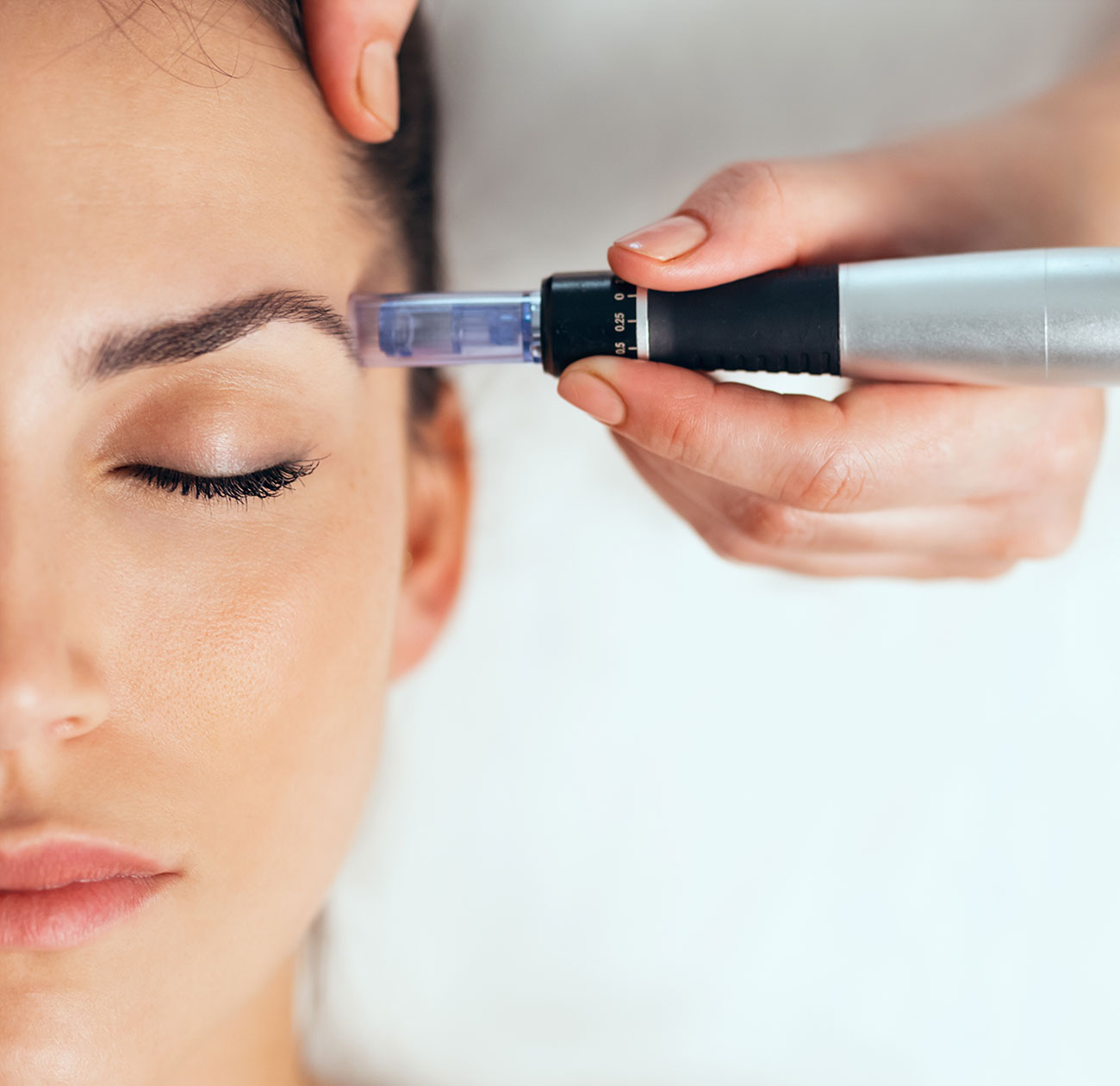 microneedlingjpg microneedlingjpg